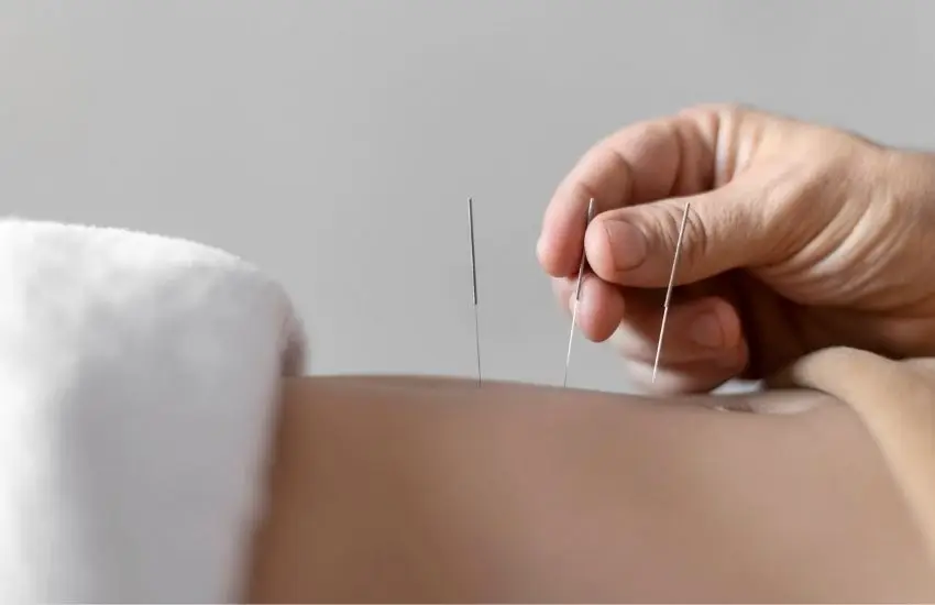 Akupunktur Uygulamaları